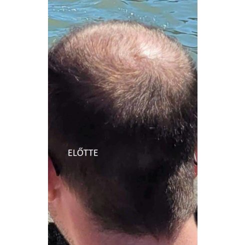 fito.C - Caffeine Anti Hair Loss Revitalizing Tonic for Women - Koffein Hajhullás Elleni Revitalizáló Tonik Nőknek, 20ml - TESZTER