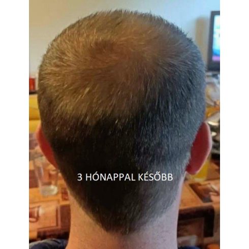 fito.C - Caffeine Anti Hair Loss Revitalizing Tonic for Women - Koffein Hajhullás Elleni Revitalizáló Tonik Nőknek, 20ml - TESZTER