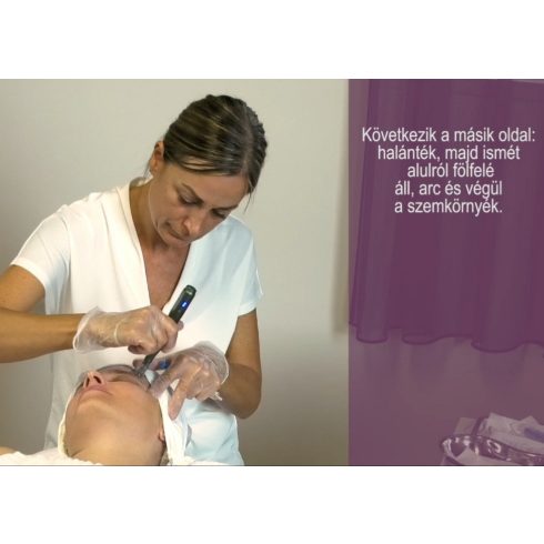 fito.C - Tűs Mezo Kezelés, 20 perc - INGYENES