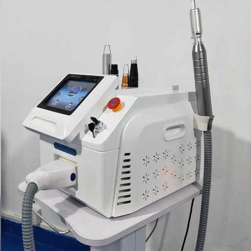 ND YAG PICOSECOND LÉZER - br. 1099eFt - CARBON PEELING - TETOVÁLÁS ELTÁVOLÍTÁS - PIGMENT FOLT HALVÁNYÍTÁS - RENDELÉSRE